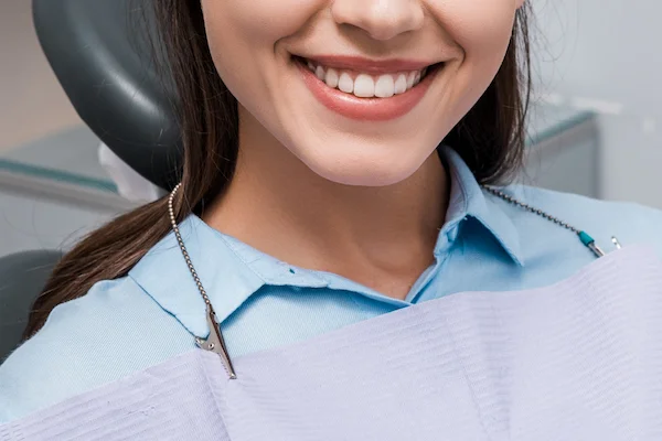 Carillas dentales y estética dental